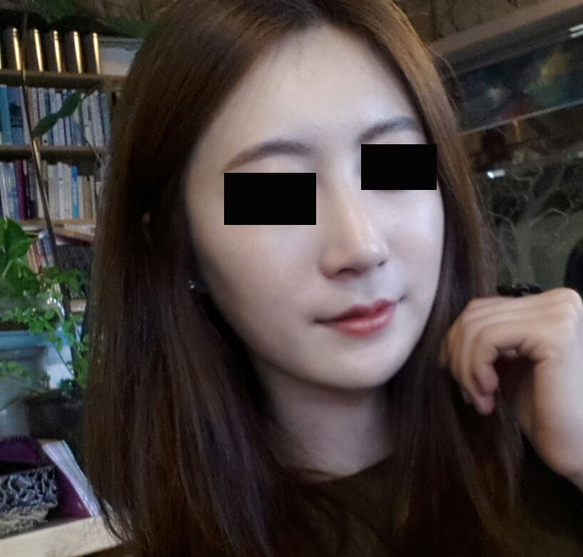 코6.jpg